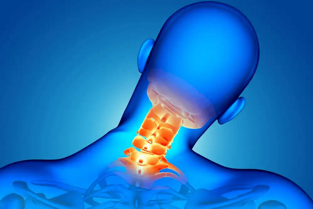 Ankylosing-Spondylitis-1.png