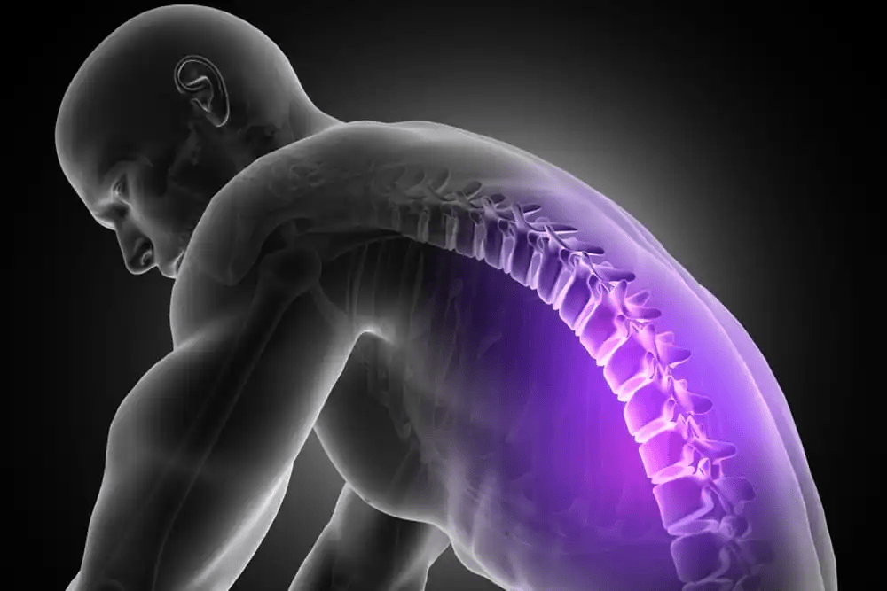Backpain-1