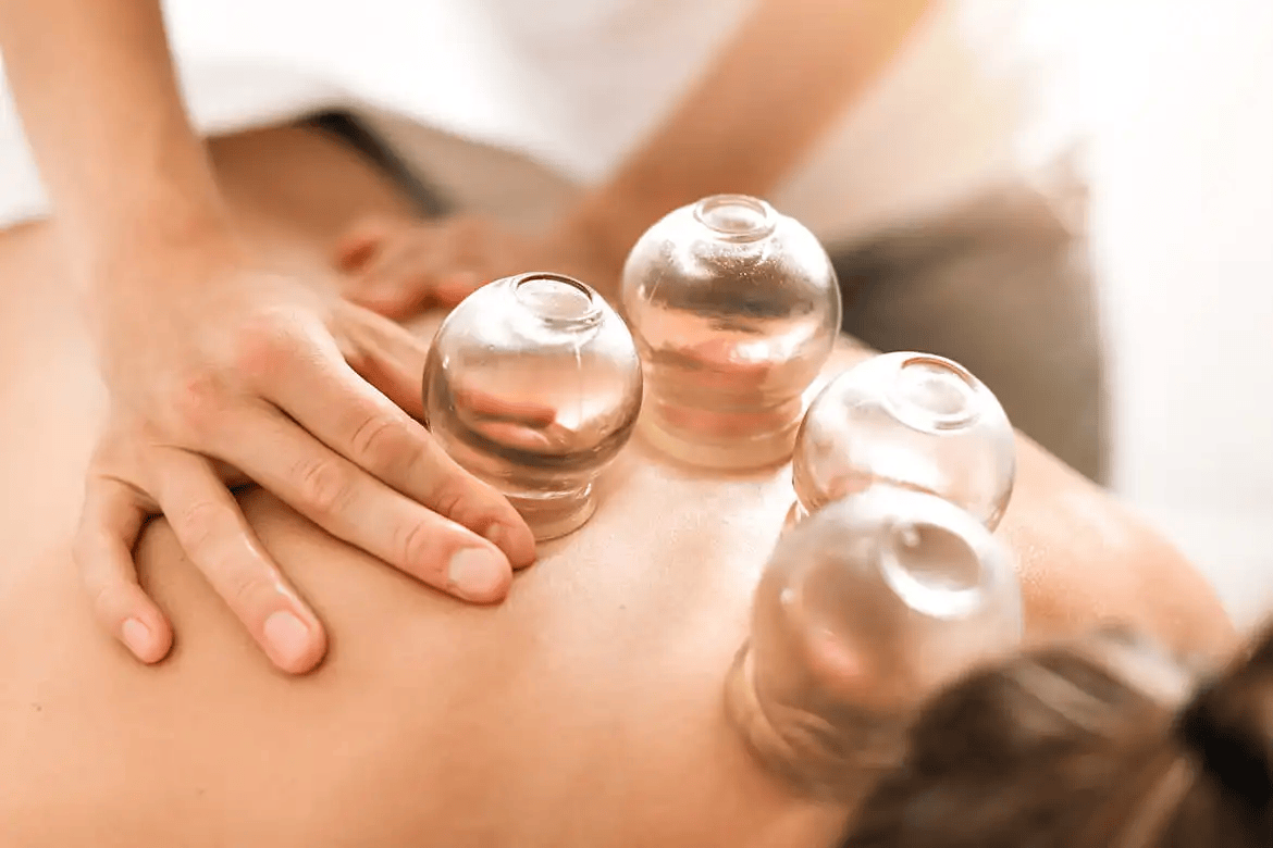 Could_You_Benefit_From_Cupping_Therapy