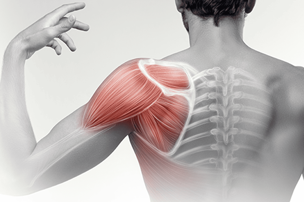 Shoulder-Pain-1