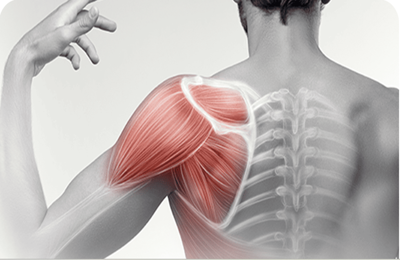 shoulder pain