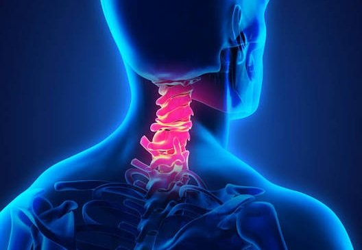 provide Cervical Spondylosis Treatment