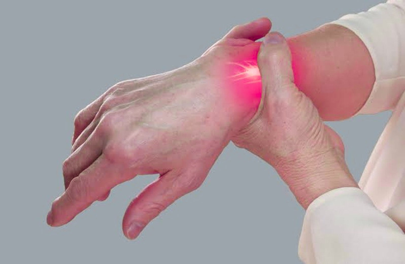 Carpal Tunnel Syndrome